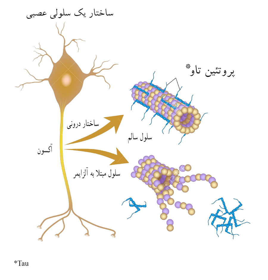 گالانتامین؛ از اودیسه تا آلزایمر