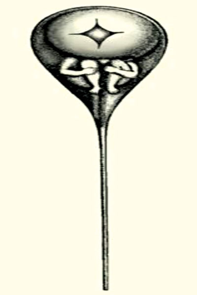 شکل ۲. تصویر پیش تشکیل بلروری از محتوای اسپرم