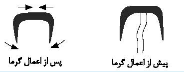 چگونگی اعمال فشار بست در محل شکستگی