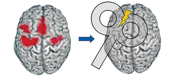 فاصله سیم‌ پیچ نسبت به چین و شکنج‌ های قشر مغز